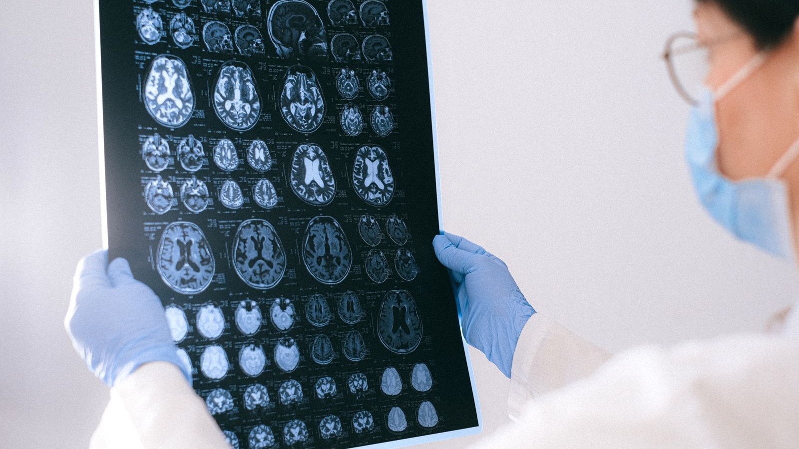 Un professionnel de santé examine des clichés d'IRM cérébrale